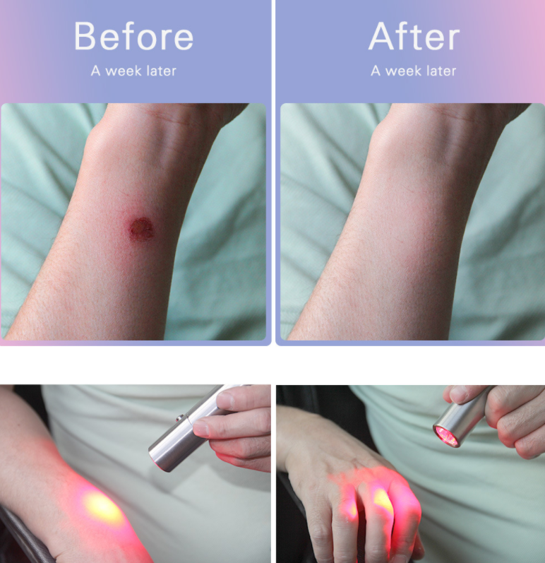 Red Light Therapy Flashlight