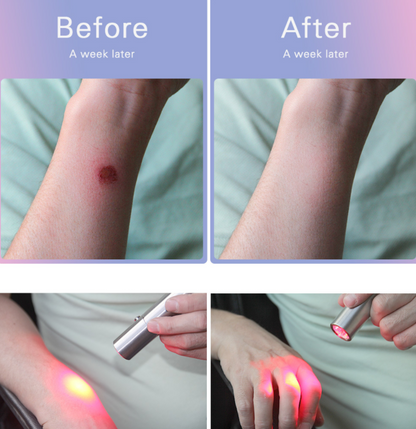 Red Light Therapy Flashlight